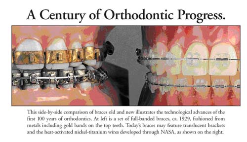 orthodontics history merrimcak nh