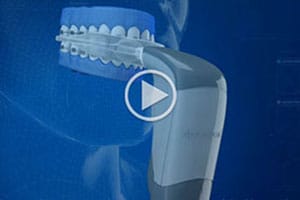 Acceledent Elliott Orthodontics Merrimack New Boston NH